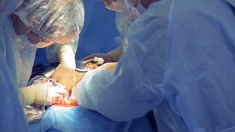 Caesarean Section Surgeon Cutting Stomach の動画素材 ロイヤリティフリー Shutterstock