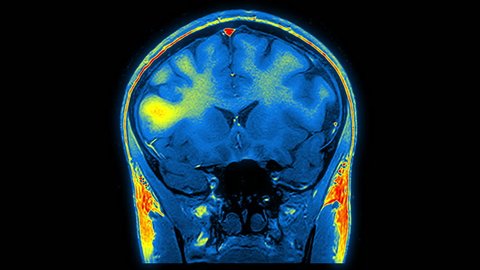 Computed medical tomography MRI upscaled scan of healthy young female brain. Front/rear view. Optically retimed for smooth motion. Red, yellow, blue on black background.  