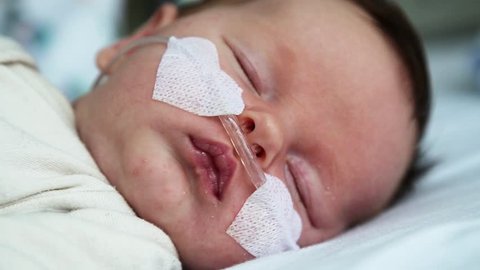Newborn baby in hospital weakened with bronchitis is getting oxygen via nasal prongs to assure oxygen saturation 