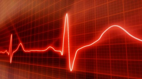 seamless loop red background EKG electrocardiogram pulse real waveform
