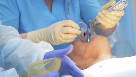 Doctors put tubes into patient's mouth, while performing surgery. 4K.