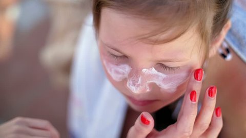 close-up, the child, girls, severe sunburn on the face. Mom smears places of burns abundantly with a special cream. Mother applying sun protection cream to her daughter face
