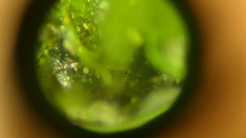 
Microscope zooms to view of moss with focussing
