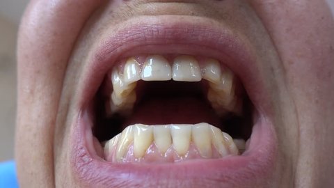 4K Close up bottom view on worn teeth of a forty years old woman
