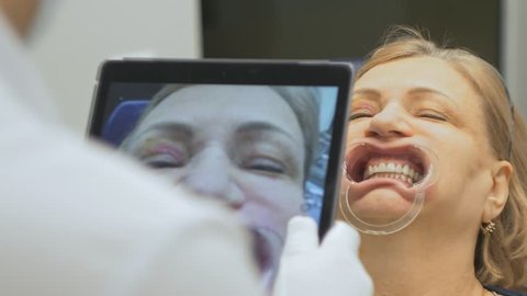 The doctor in a special computer program loaded into the tablet checks and regulates the bite. Gives a photo with a tablet. The program automatically checks the data and shows overbite. The dentist is