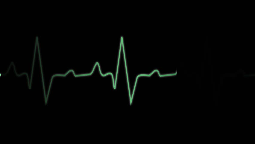 Ekg Ecg Monitoring Cardiogram Normal の動画素材 ロイヤリティフリー Shutterstock