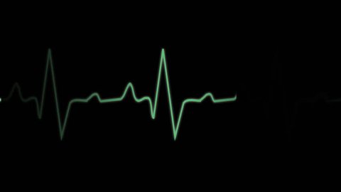 EKG ECG monitoring cardiogram, normal sinus rhythm, normal heart wave 
