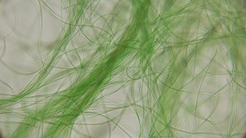 movement of live algae under a microscope, similar to the tentacles of the body, which is very exciting
