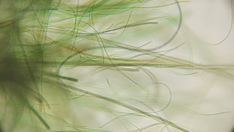 movement of live algae under a microscope, similar to the tentacles of the body, which is very exciting