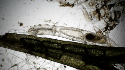 worm oligochaet under the microscope
