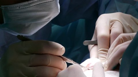 The doctor's hands make an incision with a scalpel on the patient during the operation. The nurse holds the gauze around the notch. Plastic surgery for blepharoplasty