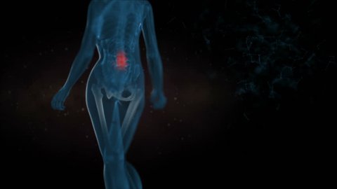 x-ray style - medical 3d animation of a female having acute pain in the back