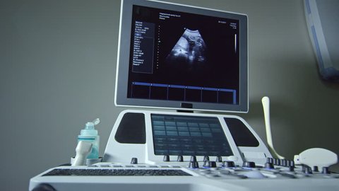Panning shot of modern ultrasound machine with image of baby on screen