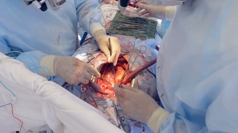 Real heart beats through open chest during surgery.