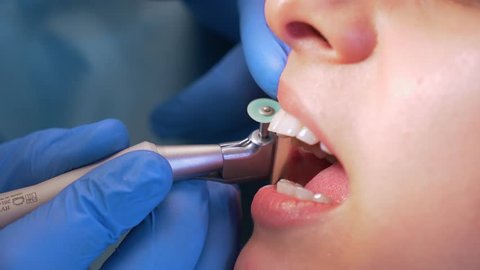The dentist treats the patient's teeth in a dental clinic