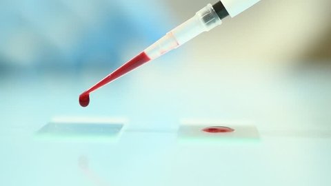 blood test. pipette with drop of blood