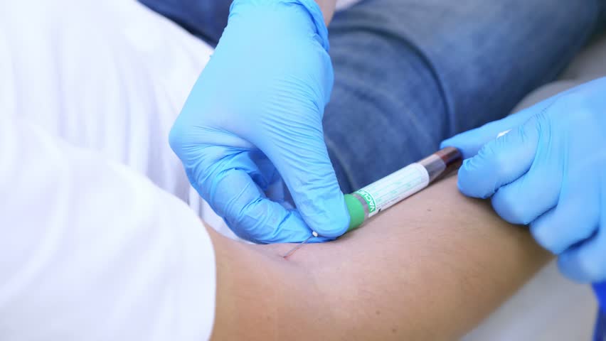 The Doctor Makes Blood Sampling Stock Footage Video (100% Royalty-free ...