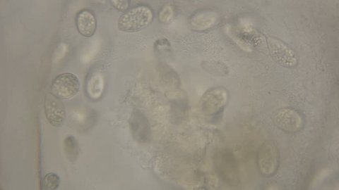 colony of ciliates etrahymena pyriformis eating snail eggs and being parasites, under a microscope