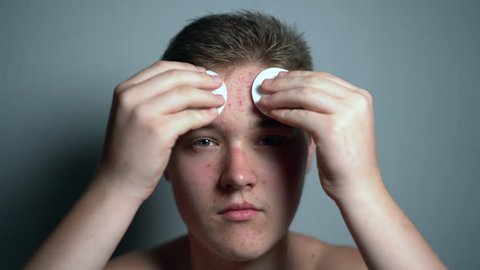 Teenage boy with the problem of acne during puberty, looks at himself in the mirror. Close-upV