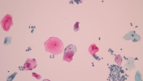 View in microscopic of normal human cervical epithelial cells in pap smear slide screening. Cytology and pathology diagnosis.Medical concept. Under microscope, magnification 400X