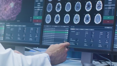 Close-up on the Hands of the Scientist Showing and Pointing at CT/ MRI Brain Scan Images on a Personal Computer in Laboratory. Shot on RED EPIC-W 8K Helium Cinema Camera.
