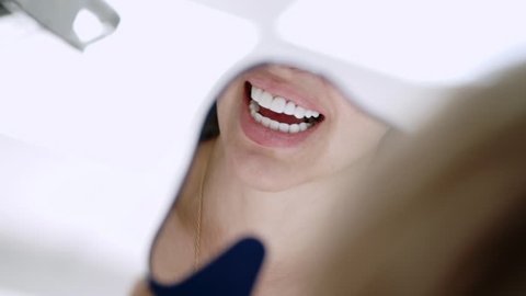 Patient in dental clinic on chair smiling with veneers