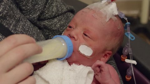 This is a shot of a little new born baby at the NICU drinking a bottle of formula
