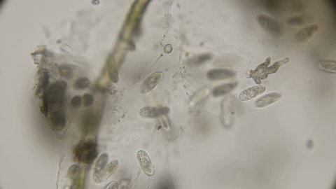 colony of Paramecium infusorium feeding on algae, under a microscope