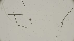 microorganism Heliozoa, Acanthocystis under the microscope - Powered by Shutterstock - Get 15% off with code: PIKWIZARD15