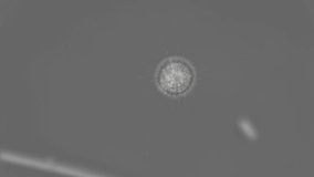 microorganism Heliozoa, Acanthocystis under the microscope - Powered by Shutterstock - Get 15% off with code: PIKWIZARD15