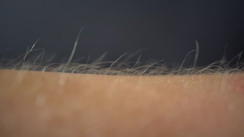 Arms Hairs Standing Up, Macro