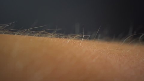 Arms Hairs Standing Up, Macro