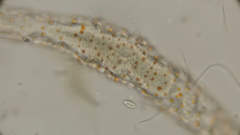 worm of the family Aeolosomatidae, Aeolosoma hemprichi, under the microscope