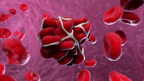 medically accurate 3d animation of a blood clot