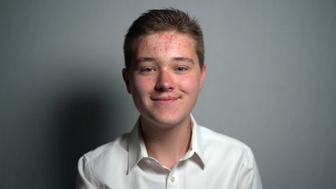 Young man with puberty acne problems looking at the camera in the studio on the grey background. Guy smiling and touching his allergic face skin. Young people in need of treatment. Skin care concept
