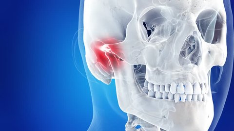 3d rendered medically accurate illustration of a painful Temporomandibular joint 