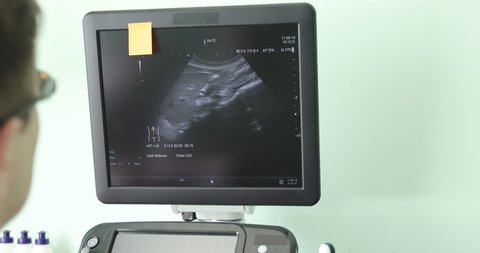 Ultrasound machine with monitor. Modern equipment. Medicine. Close-up.