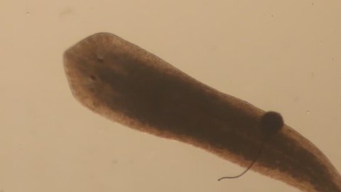 Planarian under microscope view,parasite(flatworm). 