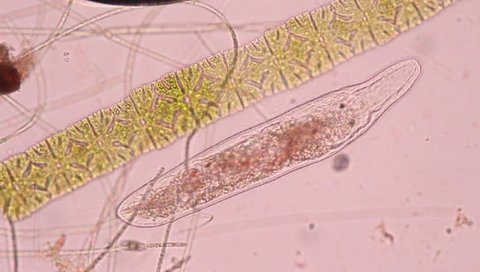 Platyhelminthes under microscope.