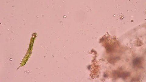 Euglena under microscope view.
Euglena is a single-call flagellate.