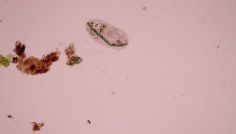 Protozoa,paramecium is a genus of unicellular ciliated protozoa.