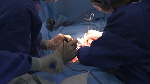Surgery operation on liver conducted by two doctors in a special room
