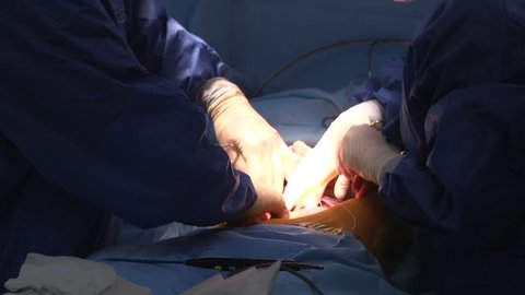 Surgery operation on liver with an uconscious patient and two doctors in gloves