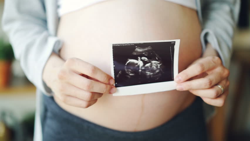 Close-up shot of big pregnant tummy and woman's hands holding sonogram image of healthy unborn baby. Pregnancy, women's health and people concept. Royalty-Free Stock Footage #1015589965
