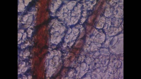 1980s: UNITED STATES: micro cinematography of leucocytes in blood vessels. Time lapse of cells in movement and growth stages
