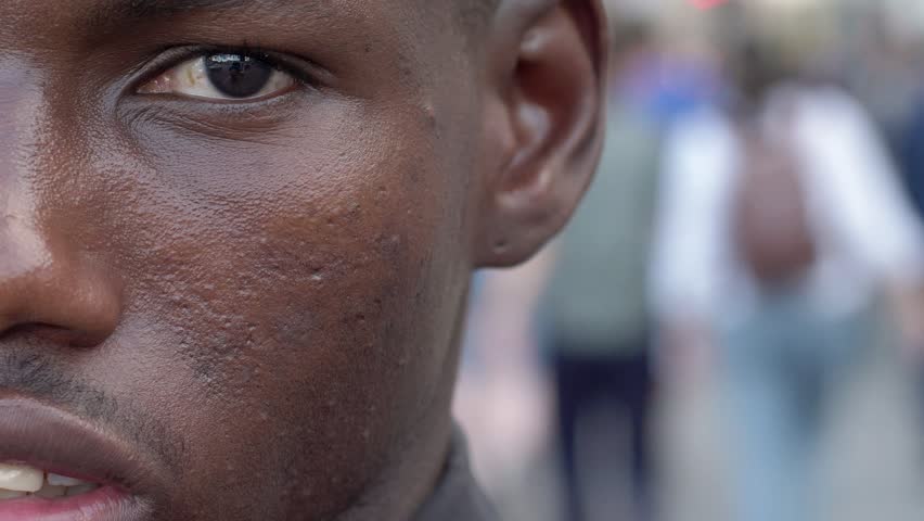 young black immigrant staring at camera- half face- outdoor- slow motion