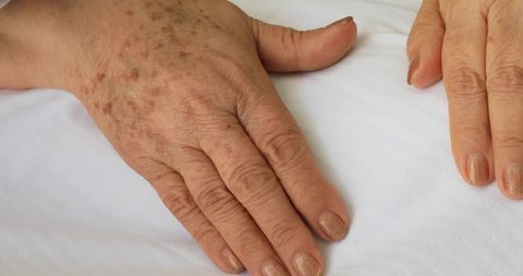Old female hands full of freckles