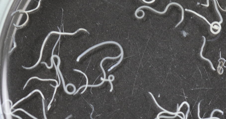 Ascaris videó pinworms mi ez hogyan kell kezelni