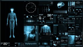 Blue futuristic patient monitor screen in perspective / Medical screen interface. Screen with various parameters measured. ST-segment and heart attack detection, pace-maker analysis, and arrhythmia an - Powered by Shutterstock - Get 15% off with code: PIKWIZARD15