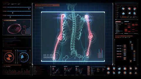 Human medical care center, main control room, 3d rendered illustration of a painful arms neuralgia bone, shoulder. medical concept. 4k animation.